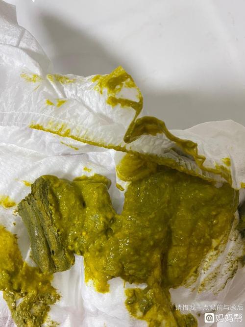 78天纯奶粉宝宝,这大便正常吗?粘粘的是