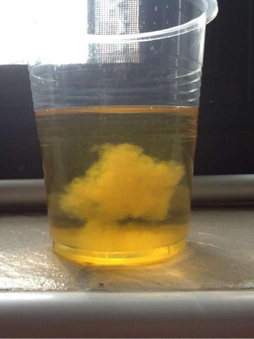 孕妇尿里放盐的变化 晨尿加盐看男女的图片