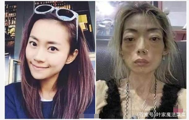 最惨前妻离婚豪门夫暴瘦剩22公斤自拍近照变这样
