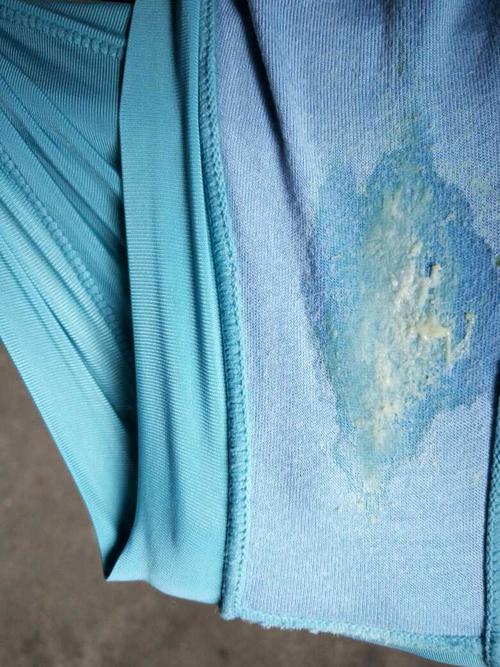 自从怀孕以后白带每天都很多