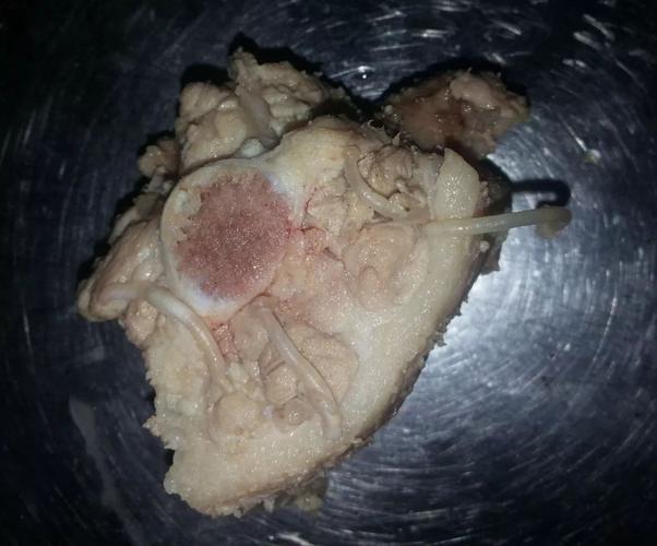 二类传染病,寄生虫病,由猪带绦虫成虫感染肠道所致,感染者常无症状;由