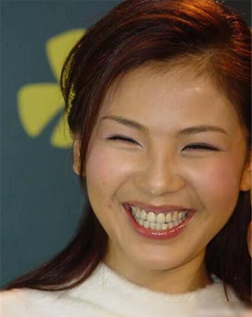 演员刘涛花了300万重做牙齿,一颗牙齿4万多,明星的钱真好赚