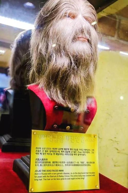 全身长满长毛的犬面人让人既感到好奇,又有一丝心酸,罕见的疾病,造成