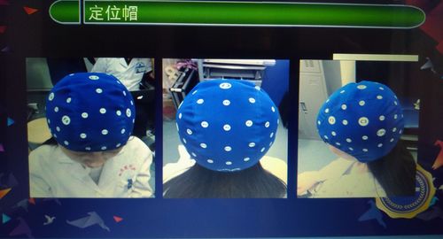 以科技关爱健康,涉县医院康复科率先引进——"经颅磁刺激仪".