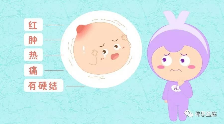 母乳的路上,搬走乳腺炎这个绊脚石