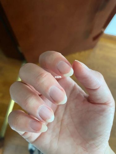 有手指甲是这样颜色的吗?_美妆_我的美妆分享_美妆