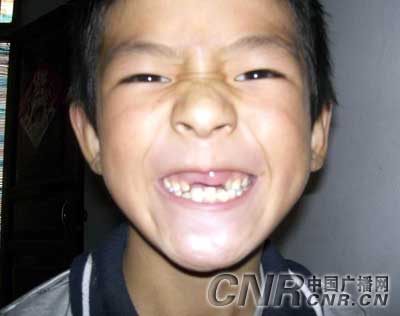 甘肃徽县"血铅超标"事件再追踪
