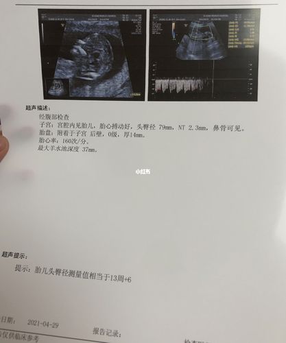 13周nt过了,偏大3天_nt检查_母婴_孕产经验