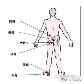 3,对出现瘫痪或偏瘫的患者,要特别注意肢体位置,并协助选择合适的
