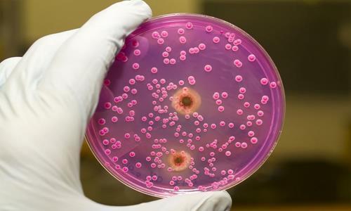 说说外阴阴道假丝酵母菌病