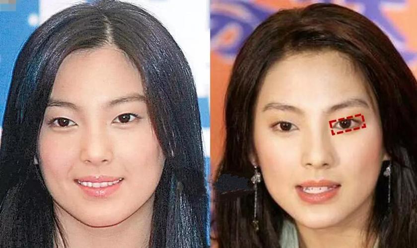 她在出道的时候还是单眼皮,这意味着 眼型更窄更狭长,看起来就会更加