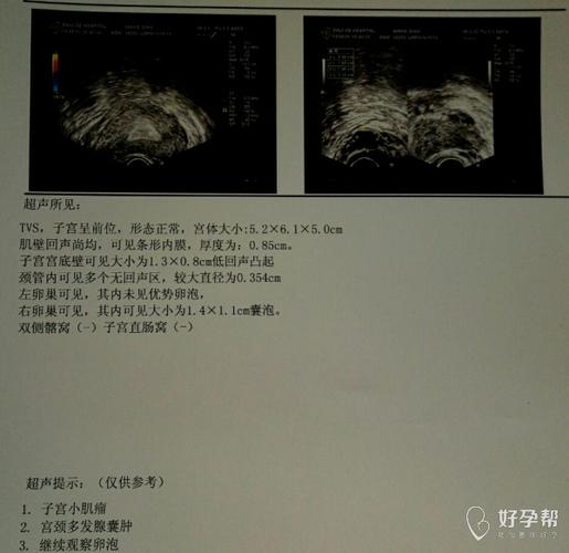 今天测排卵试纸像强阳,就去医院观察卵泡的发育情况: &8月1号测右侧