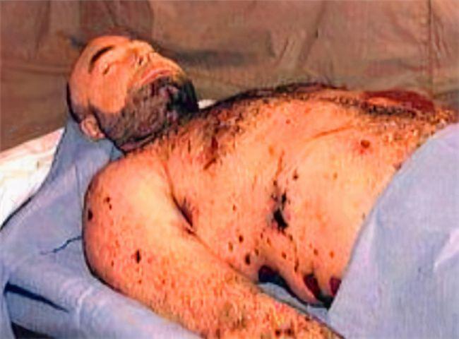 子弹贯穿身体却奇迹存活下来最终他成了学者研究人体的试验品