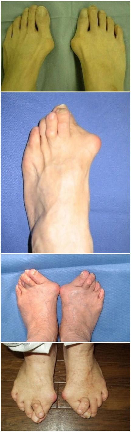 一组脚的图片,看看我们的脚掌,脚趾头,每天那个累啊