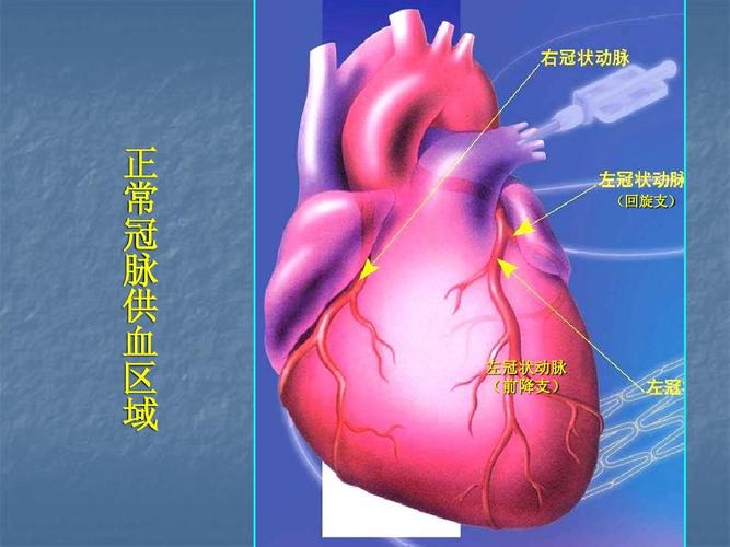 正 常 冠 脉 供 血 区 域 (回旋支) 左冠状动脉 (前降支)