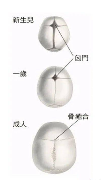 神外科普 | 孩子出现奇怪头型 — 谨防颅缝早闭