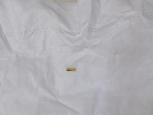 【讨论】这是绦虫节片吗