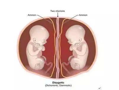 怀双胞胎需要注意什么呢?|妊娠|胎儿|羊水|早产|子痫_网易订阅