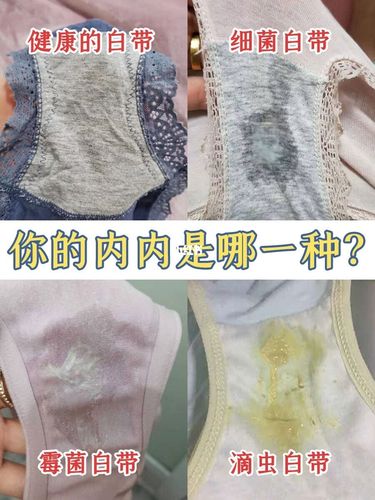 白带不正常你怕了吗?_男朋友_妇科炎症_缩阴_私密护理