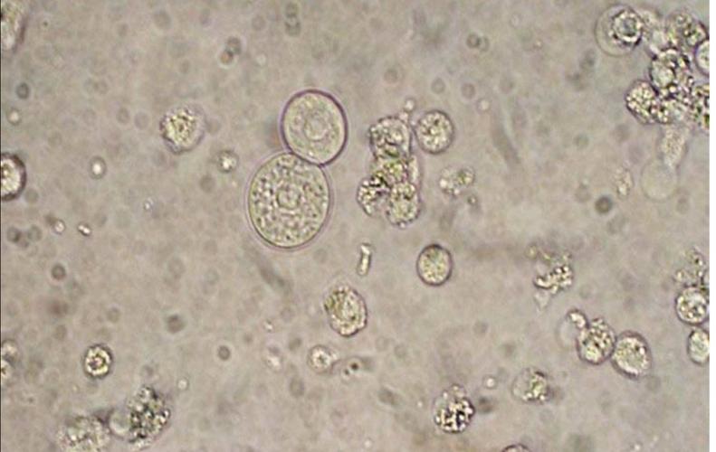 表层移行上皮细胞,呈圆形或梨形,俗称大圆上皮细胞.