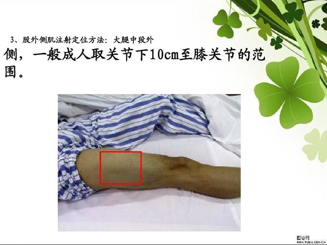 3,股外侧肌注射定位方法:大腿中段外 侧,一般成人取关节下10cm至膝