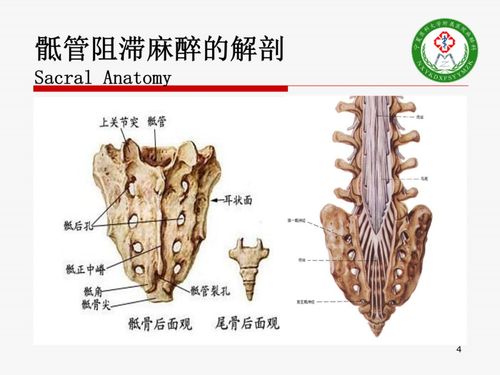【推荐精彩课件】小儿骶管麻醉(可下载)