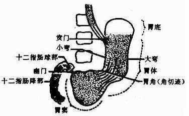 胃角溃疡严重吗导致胃角溃疡的具体原因又是什么