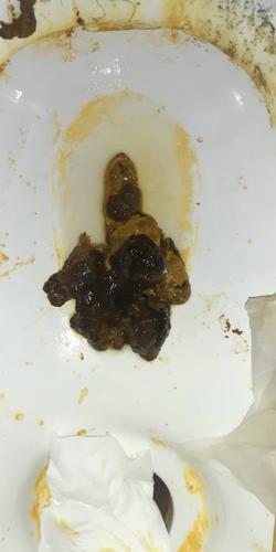 请问各位这个是黑便吗