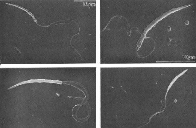 千奇百怪的昆虫精子