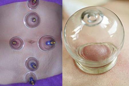 拔罐减肚子穴位图介绍 教大家几招轻松减脂