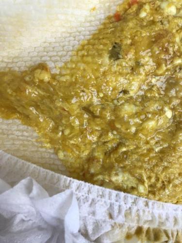 宝宝一直拉肚子,是细菌性肠炎,拉了一个多月,现在好点