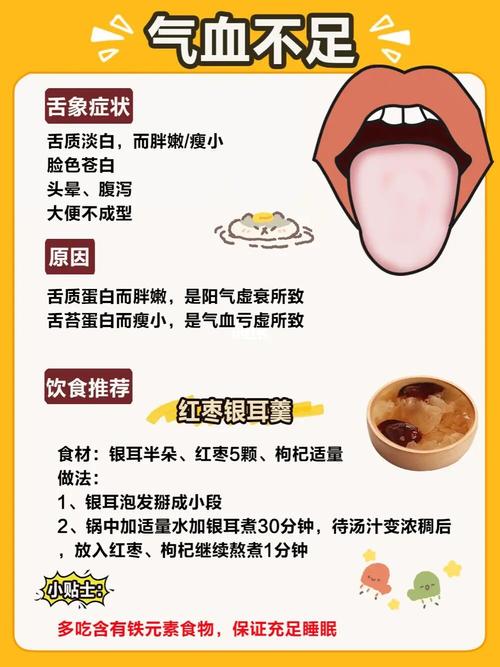 6种常见舌舌苔97出现这几种情况需注意_舌苔_看舌苔