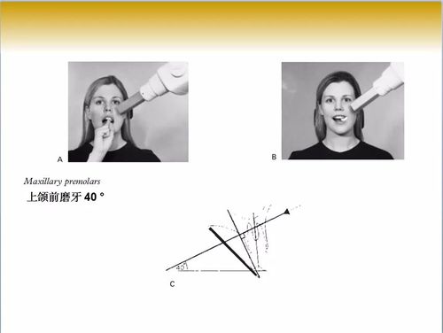 口腔x线片拍摄定位技巧