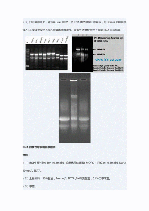 ymvkt-rna实验技术rna琼脂糖凝胶电泳.pdf 4页