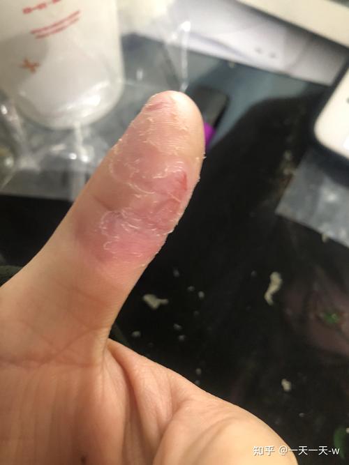 有时候还会扯小脚趾的皮,一整块撕下来感觉太舒服了,想问有没有同款!