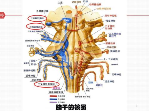 延髓背外侧综合征的康复治疗 ppt