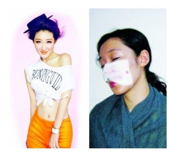 曝女演员李依馨被藏獒咬至毁容