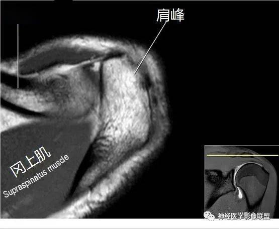 横轴位来源:神经医学影像联盟点击二维码直接报名