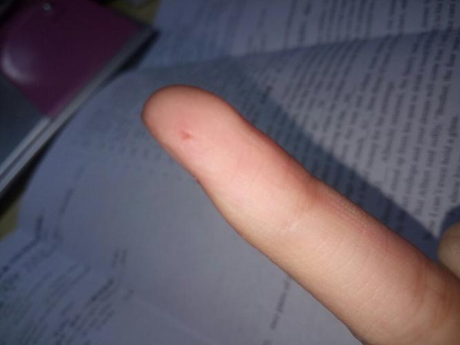 这是被仓鼠咬的还是塑胶跑道跳远刮得?