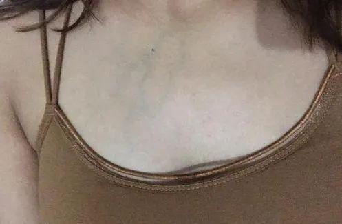 手上青筋越多,赶紧检查身体这个地方,太准了