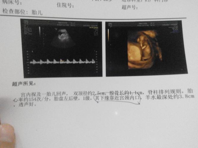 孕三个月了,宝妈会看吗?帮看看吧!第一胎