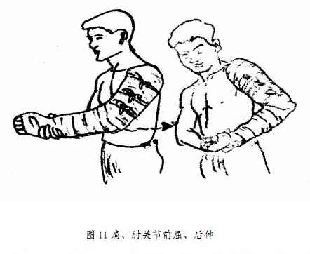 肱骨干骨折术后康复锻炼 肩周炎宜可 (转载)