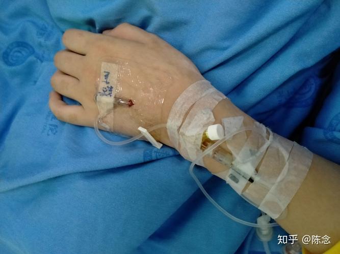 最后直到管子抽出去了,我彻底失去意识,手上扎了留置针,还有个不知道