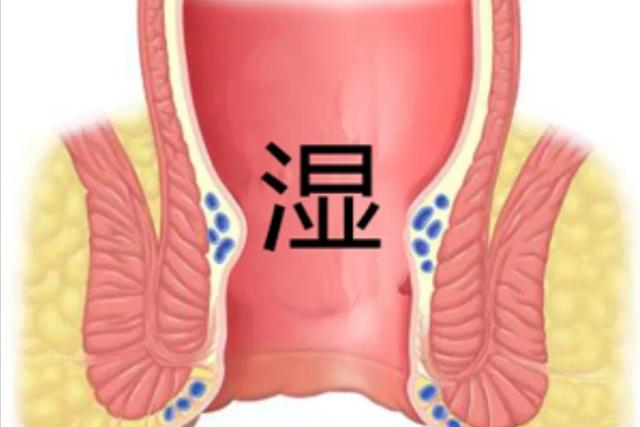 第五种, 不明原因出现自己肛门腹股沟区域淋巴结肿胀!