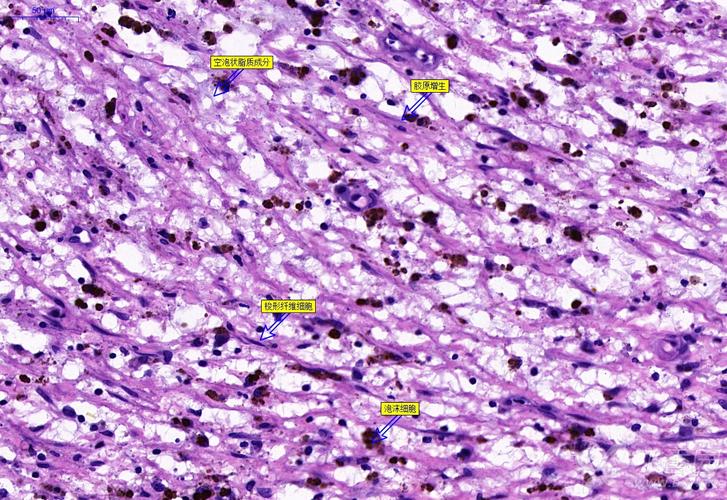 求助:人主动脉he染色切片 谢谢!
