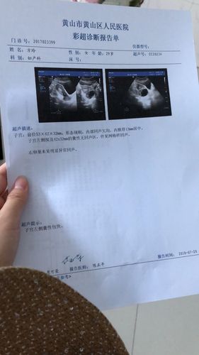 月经推迟14天「验血没怀孕」,现在左小腹有阵痛!