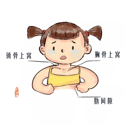 面色,口唇发青 出现三凹征