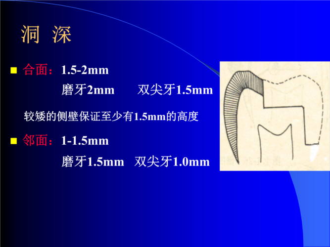牙体解剖学精品课件(中山大学)4 备二类洞 事项.pptx