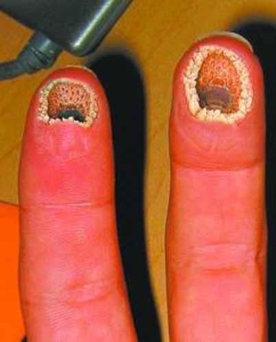 组图僵尸鱼现英国河道已绝迹200年曾被ps成空手指逼死密集恐惧症