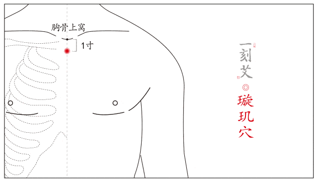 一刻艾-对症下灸丨急性肠胃炎的艾灸疗法